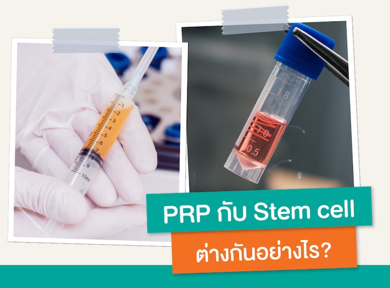 PRP กับ STEM CELL ต่างกันอย่างไร