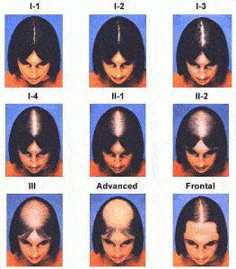 WHAT IS A REASON OF HAIR LOSS? 2