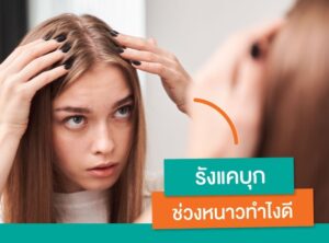 รังแคบุกช่วงหน้าหนาวทำไงดี_1