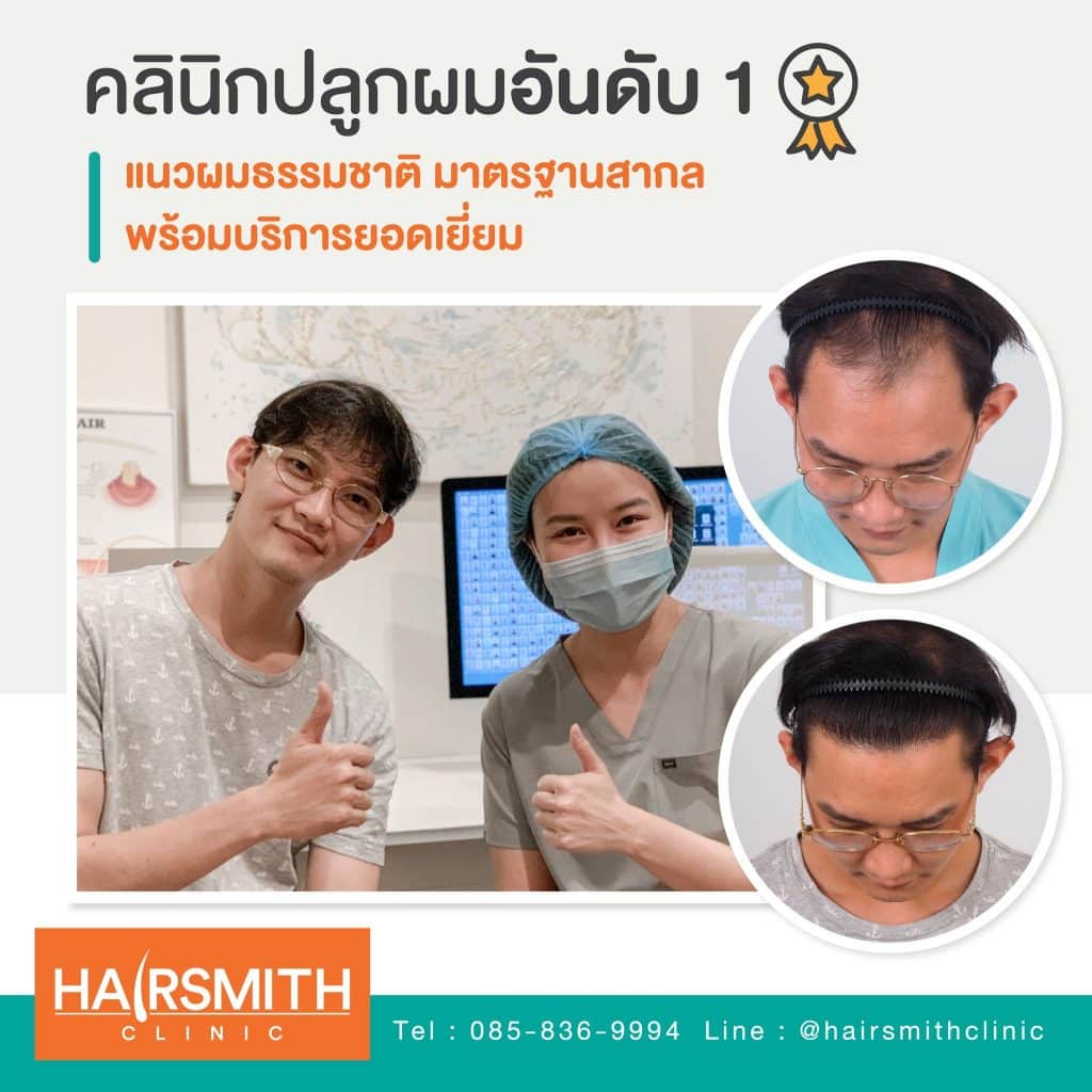 HAIR TRANSPLANT CONSULTATION AND DECISIONS_2