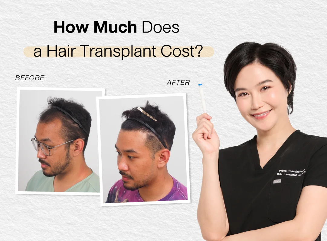 hair transplant Bankok cost