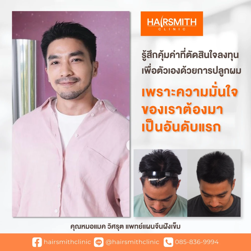 ปลูกผม เพิ่มความมั่นใจ