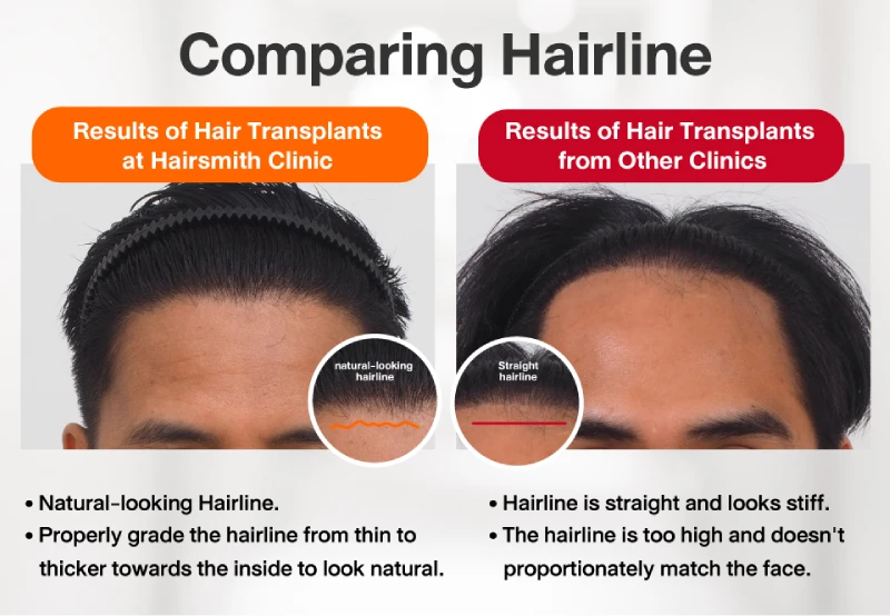 natural hairlines