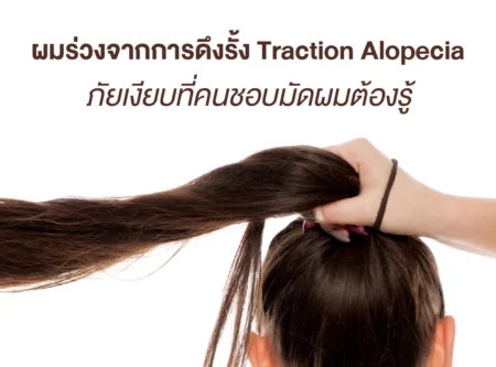 Traction Alopecia ผมร่วงจากการดึงรั้ง