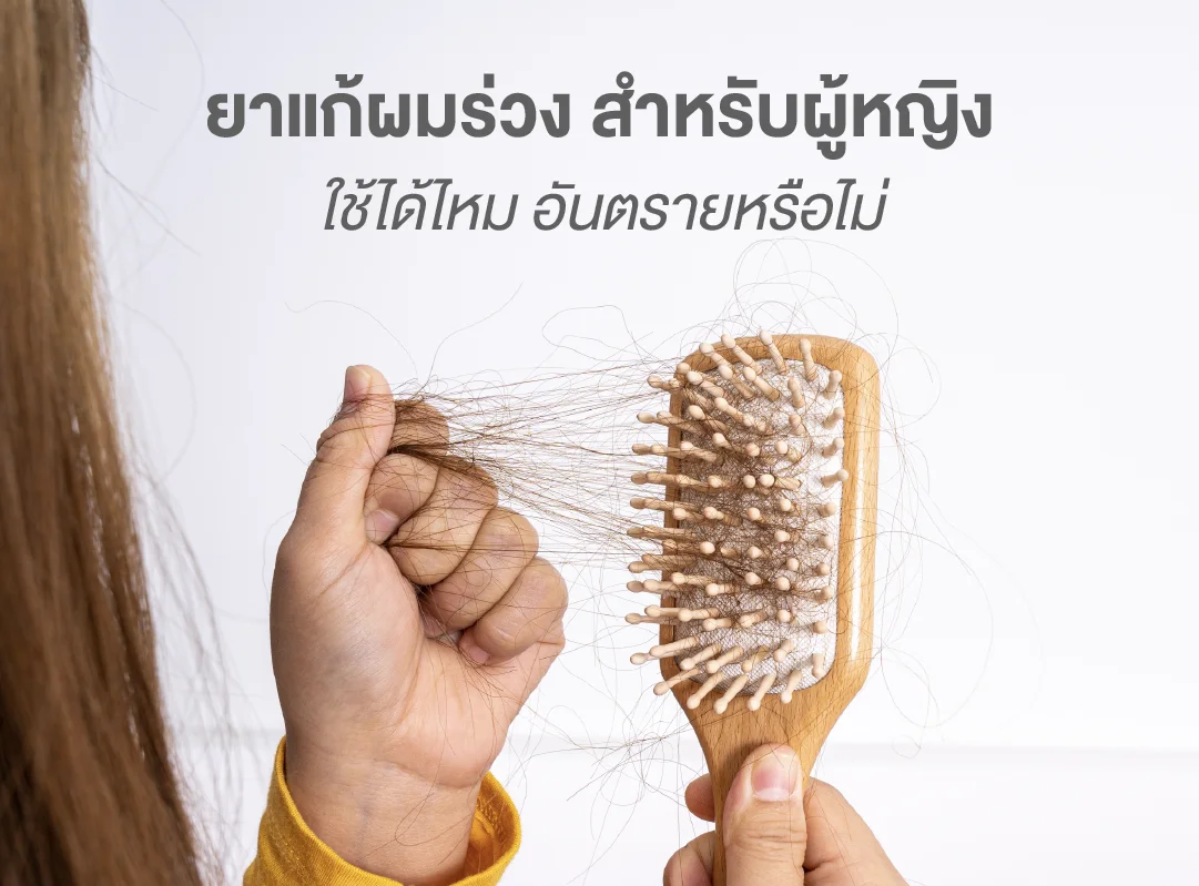 ยาแก้ผมร่วง สำหรับผู้หญิง ใช้ได้ไหม